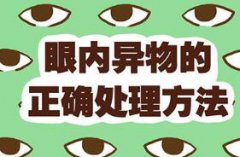 眼睛里进了东西怎么办?快看看这些小妙招