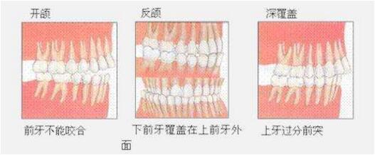 牙齿正畸 门诊时间周一到周日全天24小时接诊     上下牙齿咬合不齐